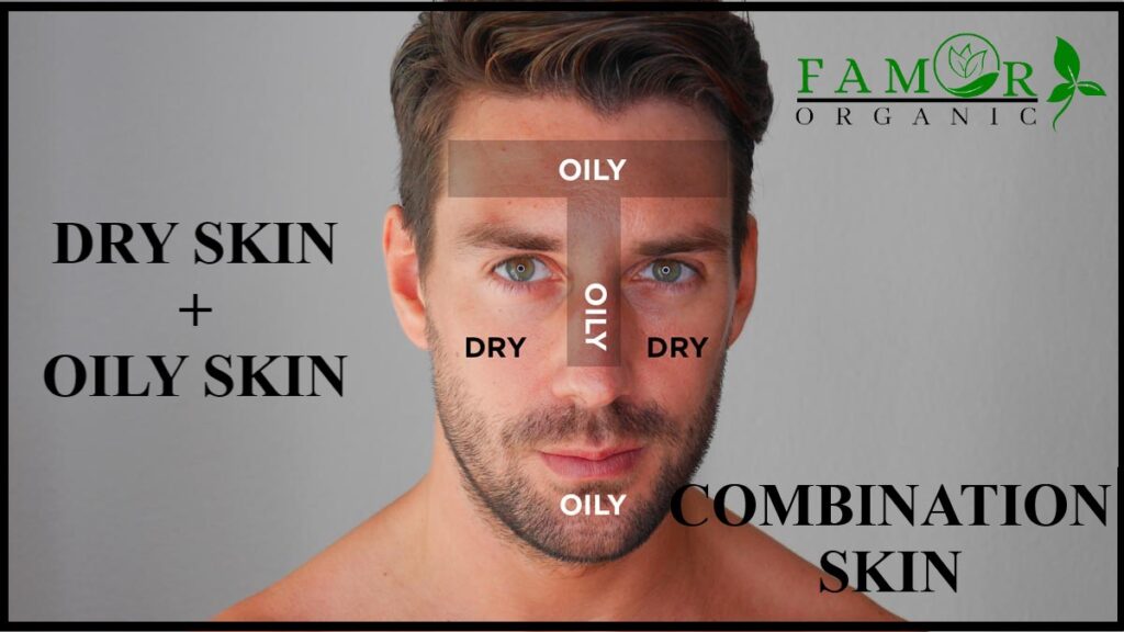 Skin Types