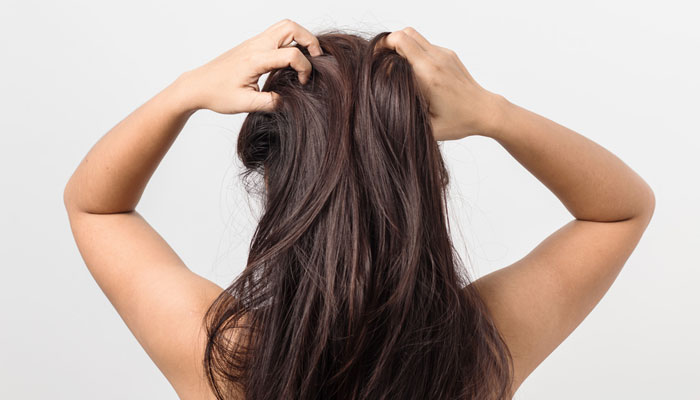 Root Causes of Dandruff in Hot Weather